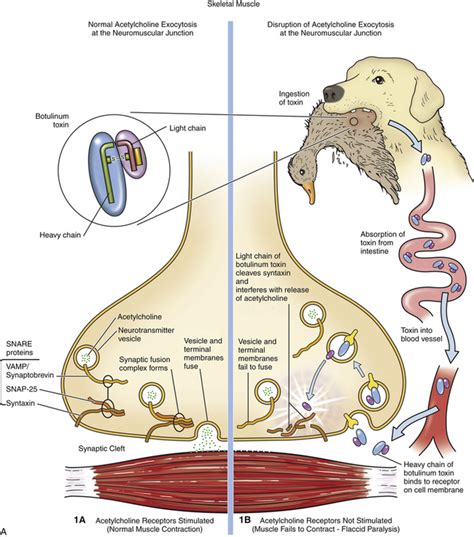 botulinum vs botulism.